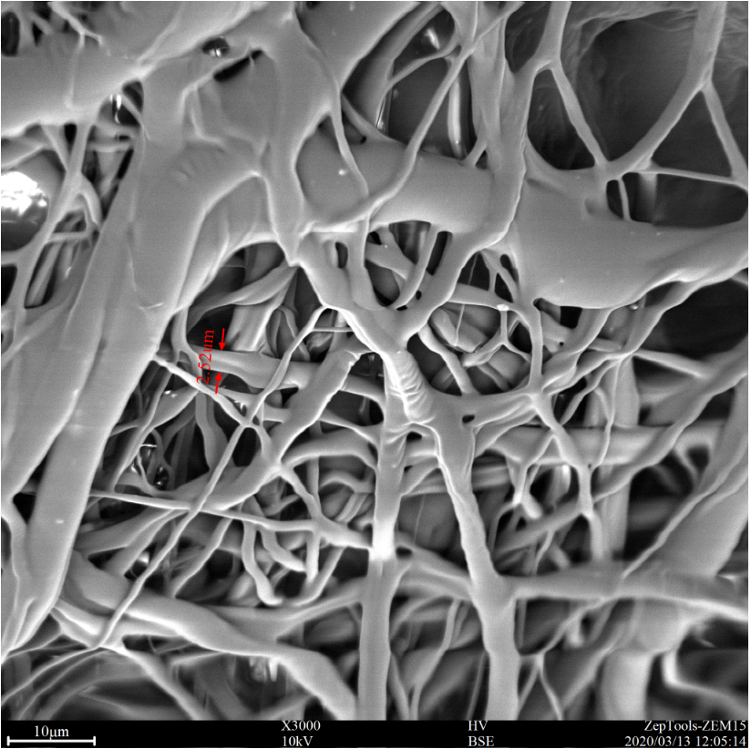 掃描電鏡下的醫(yī)用外科口罩圖片 掃描電鏡下的醫(yī)用外科口罩圖片